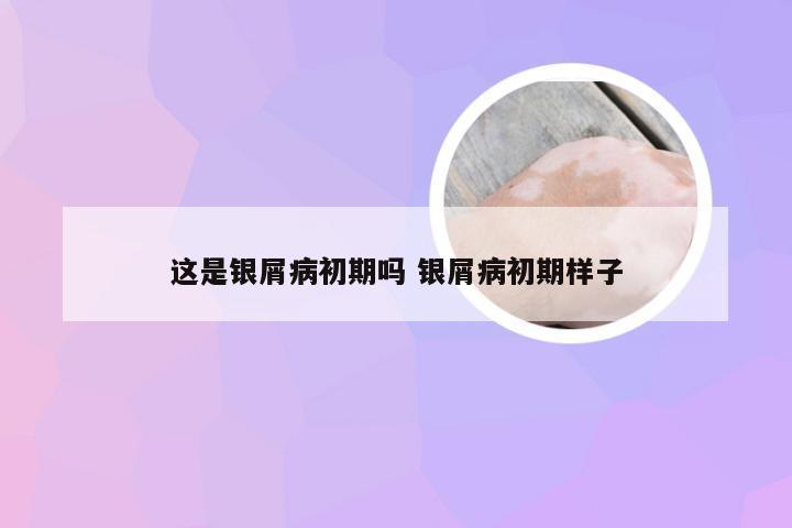 这是银屑病初期吗 银屑病初期样子