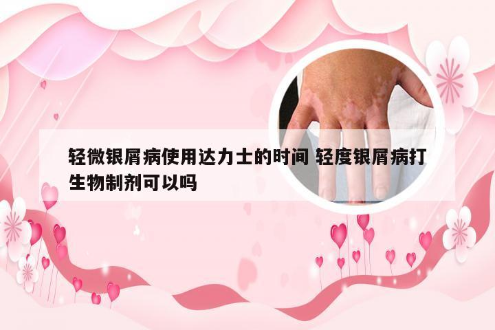 轻微银屑病使用达力士的时间 轻度银屑病打生物制剂可以吗