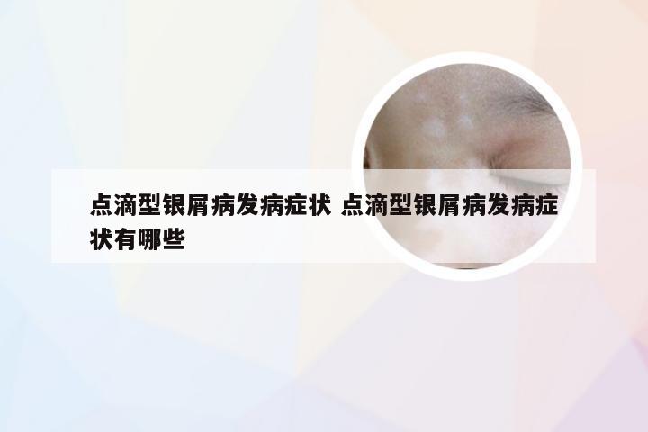 点滴型银屑病发病症状 点滴型银屑病发病症状有哪些