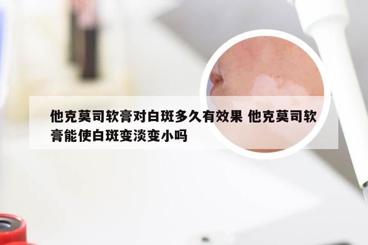 他克莫司软膏对白斑多久有效果 他克莫司软膏能使白斑变淡变小吗