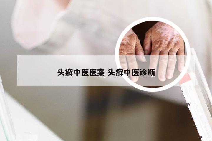 头癣中医医案 头癣中医诊断