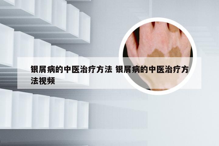 银屑病的中医治疗方法 银屑病的中医治疗方法视频