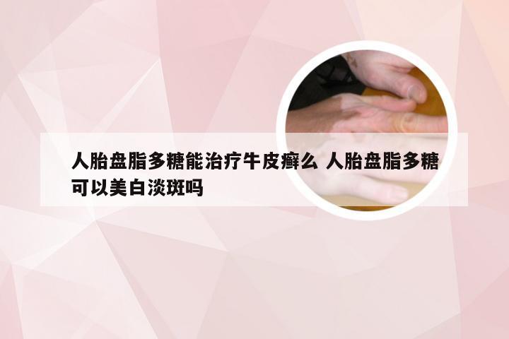 人胎盘脂多糖能治疗牛皮癣么 人胎盘脂多糖可以美白淡斑吗