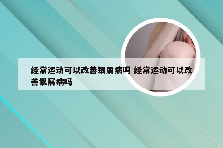 经常运动可以改善银屑病吗 经常运动可以改善银屑病吗