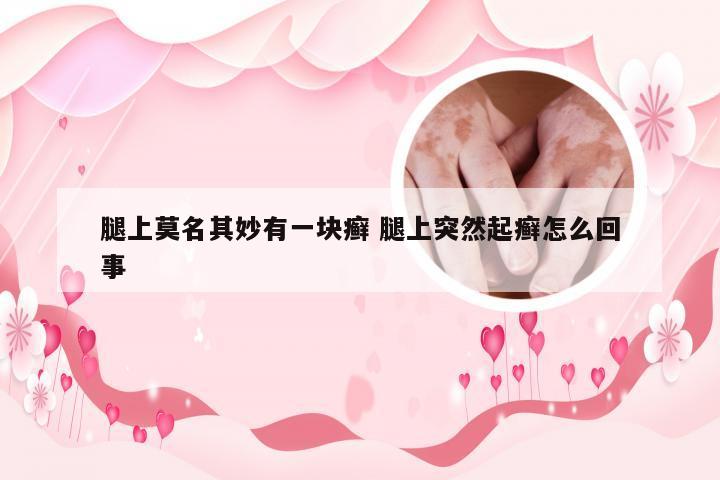 腿上莫名其妙有一块癣 腿上突然起癣怎么回事