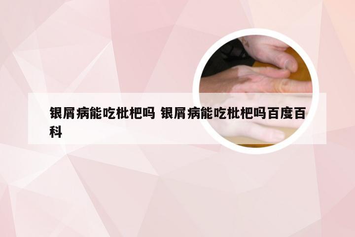 银屑病能吃枇杷吗 银屑病能吃枇杷吗百度百科