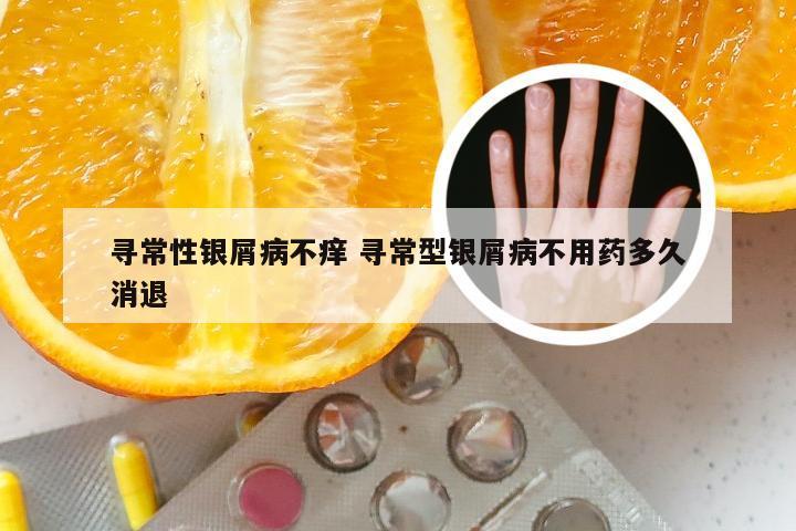 寻常性银屑病不痒 寻常型银屑病不用药多久消退