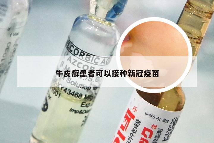 牛皮癣患者可以接种新冠疫苗