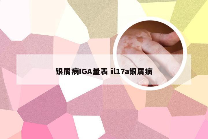 银屑病IGA量表 il17a银屑病