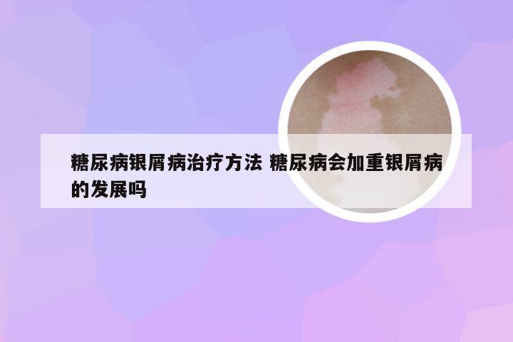 糖尿病银屑病治疗方法 糖尿病会加重银屑病的发展吗