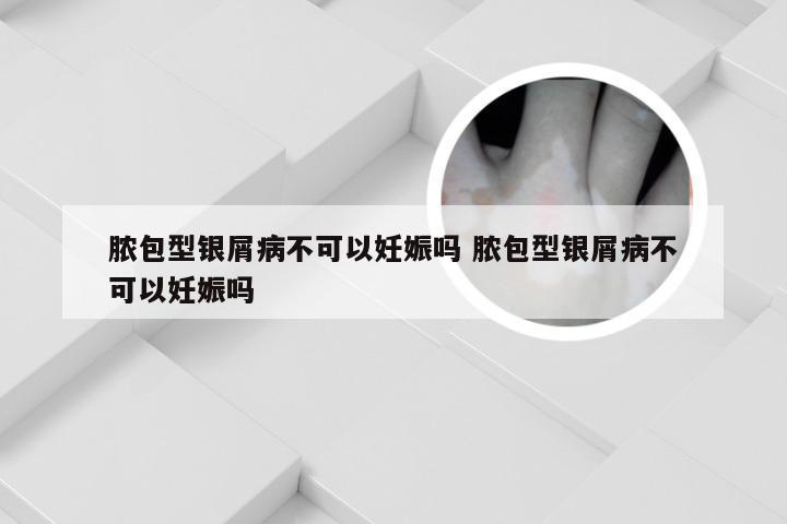 脓包型银屑病不可以妊娠吗 脓包型银屑病不可以妊娠吗