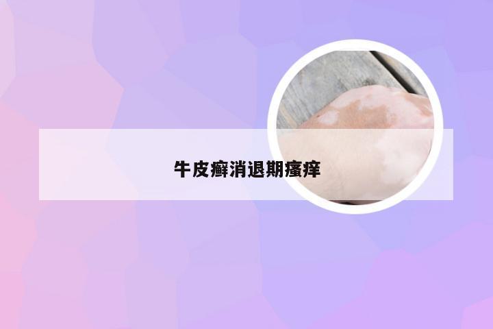 牛皮癣消退期瘙痒