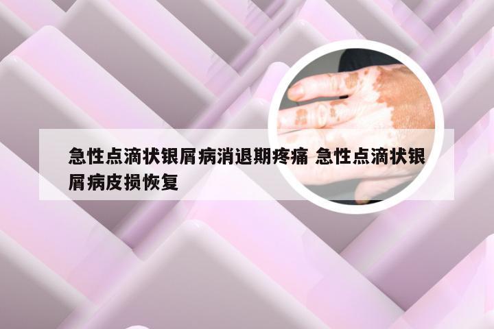 急性点滴状银屑病消退期疼痛 急性点滴状银屑病皮损恢复