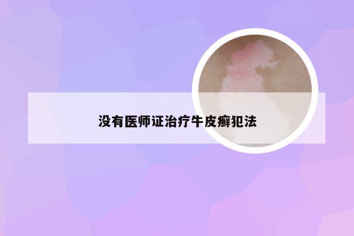 没有医师证治疗牛皮癣犯法