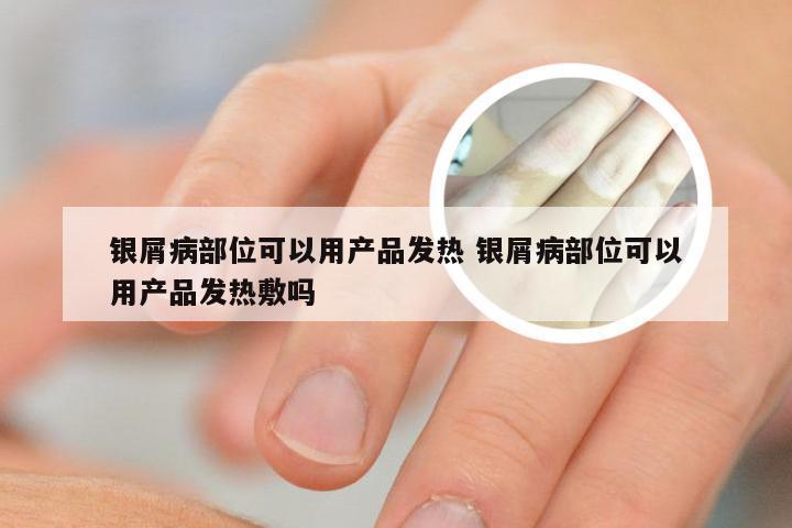 银屑病部位可以用产品发热 银屑病部位可以用产品发热敷吗