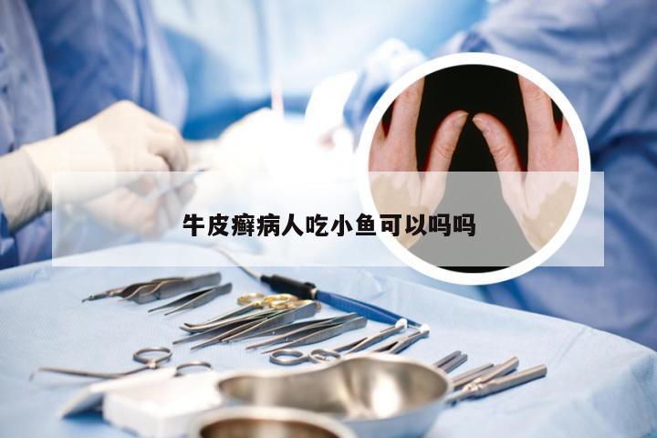 牛皮癣病人吃小鱼可以吗吗