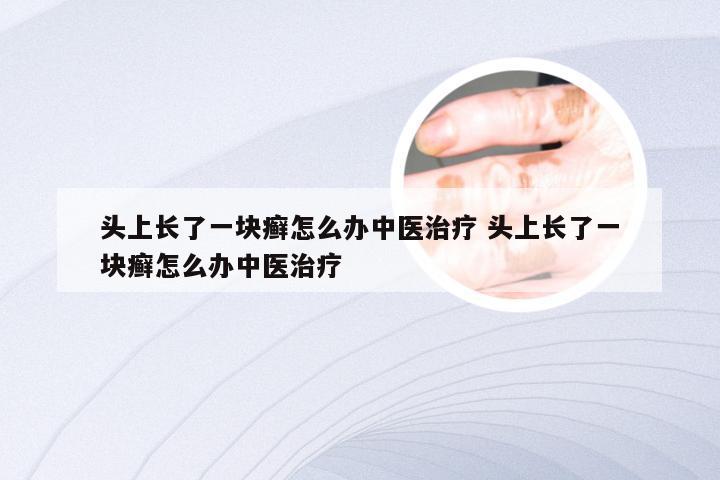 头上长了一块癣怎么办中医治疗 头上长了一块癣怎么办中医治疗