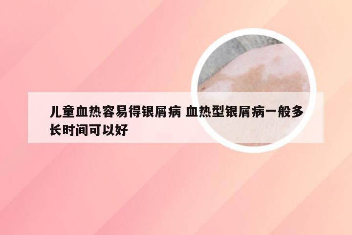 儿童血热容易得银屑病 血热型银屑病一般多长时间可以好