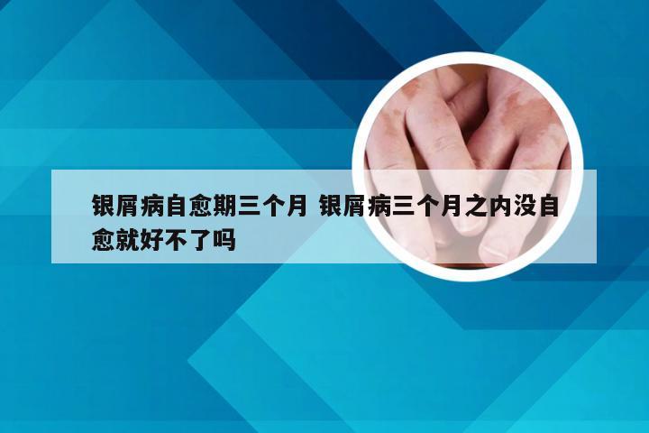 银屑病自愈期三个月 银屑病三个月之内没自愈就好不了吗