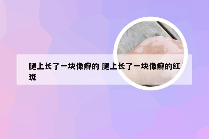 腿上长了一块像癣的 腿上长了一块像癣的红斑