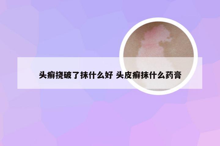 头癣挠破了抹什么好 头皮癣抹什么药膏