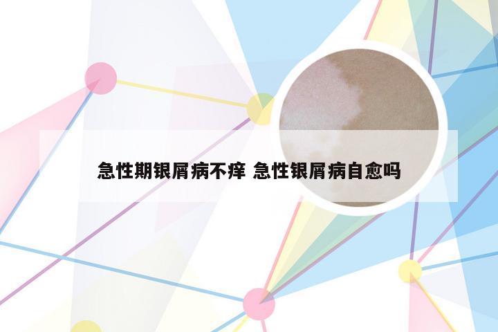 急性期银屑病不痒 急性银屑病自愈吗