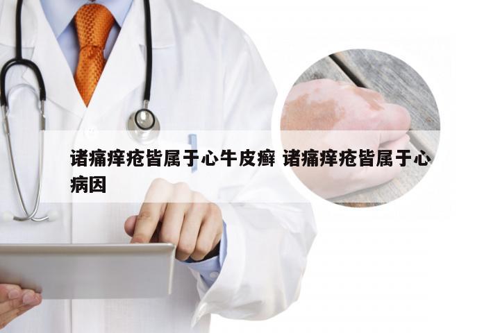 诸痛痒疮皆属于心牛皮癣 诸痛痒疮皆属于心病因