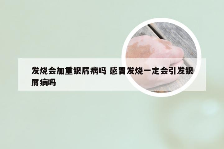 发烧会加重银屑病吗 感冒发烧一定会引发银屑病吗