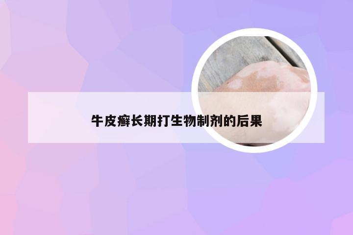 牛皮癣长期打生物制剂的后果