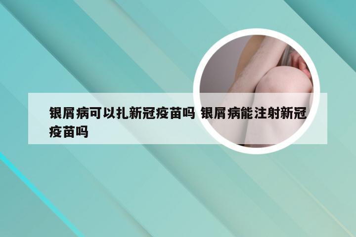 银屑病可以扎新冠疫苗吗 银屑病能注射新冠疫苗吗