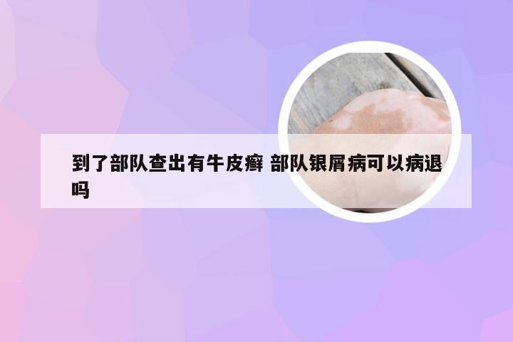 到了部队查出有牛皮癣 部队银屑病可以病退吗