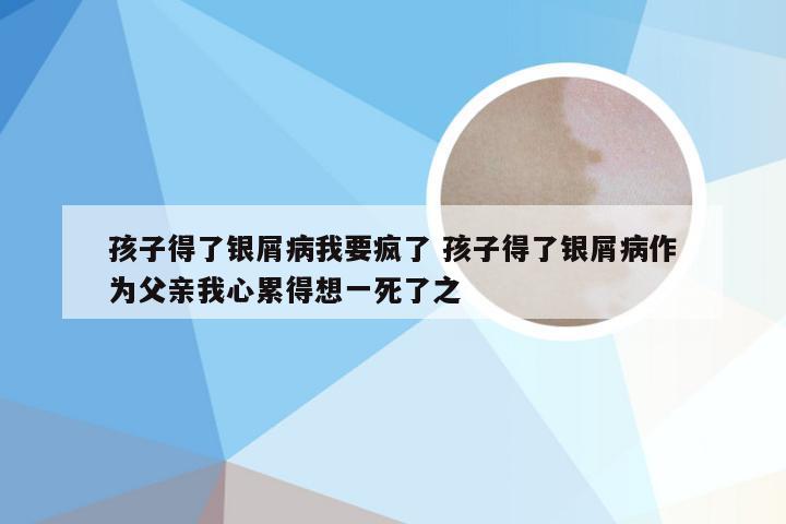 孩子得了银屑病我要疯了 孩子得了银屑病作为父亲我心累得想一死了之