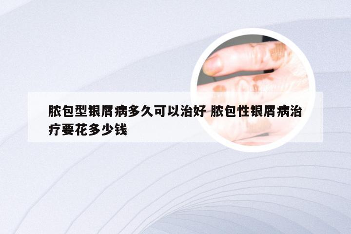 脓包型银屑病多久可以治好 脓包性银屑病治疗要花多少钱