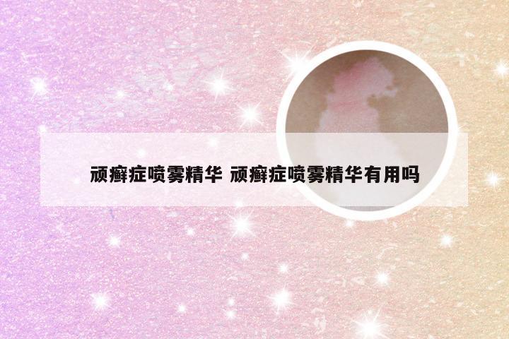 顽癣症喷雾精华 顽癣症喷雾精华有用吗