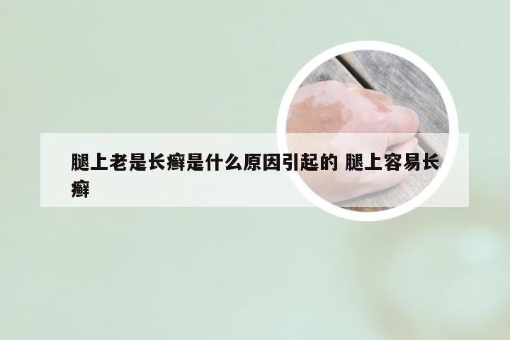 腿上老是长癣是什么原因引起的 腿上容易长癣