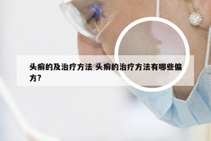 头癣的及治疗方法 头癣的治疗方法有哪些偏方?