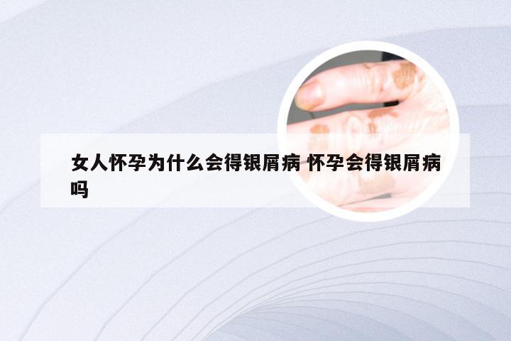 女人怀孕为什么会得银屑病 怀孕会得银屑病吗