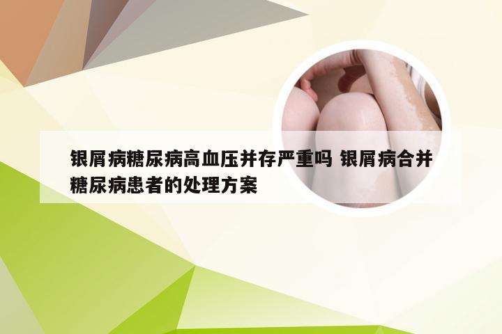 银屑病糖尿病高血压并存严重吗 银屑病合并糖尿病患者的处理方案