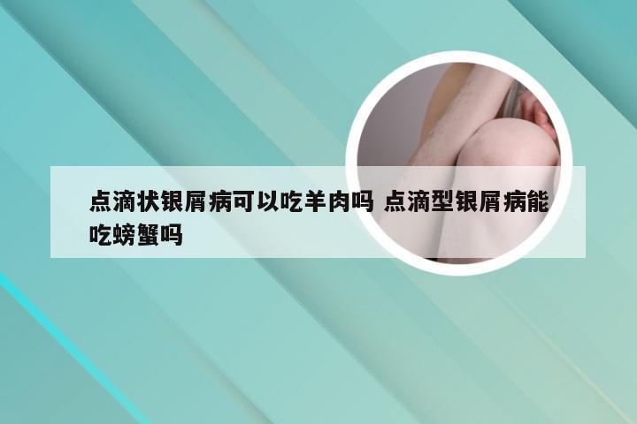 点滴状银屑病可以吃羊肉吗 点滴型银屑病能吃螃蟹吗