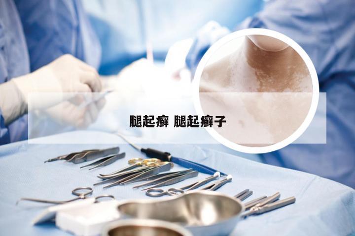 腿起癣 腿起癣子