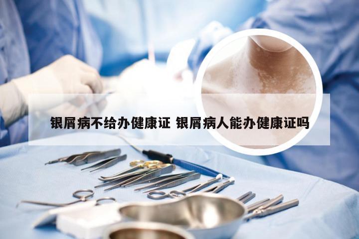 银屑病不给办健康证 银屑病人能办健康证吗