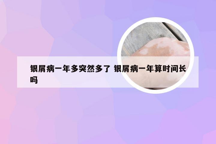 银屑病一年多突然多了 银屑病一年算时间长吗