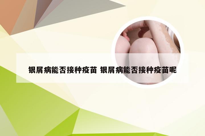 银屑病能否接种疫苗 银屑病能否接种疫苗呢