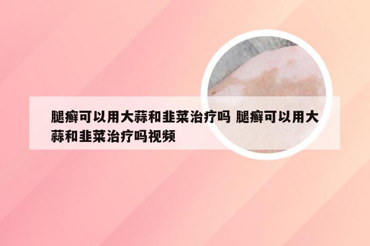 腿癣可以用大蒜和韭菜治疗吗 腿癣可以用大蒜和韭菜治疗吗视频