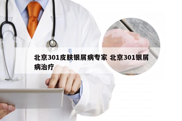 北京301皮肤银屑病专家 北京301银屑病治疗