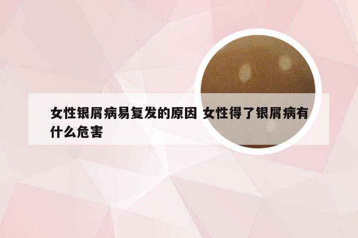 女性银屑病易复发的原因 女性得了银屑病有什么危害