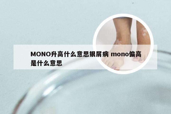 MONO升高什么意思银屑病 mono偏高是什么意思