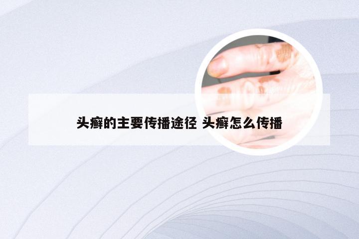 头癣的主要传播途径 头癣怎么传播