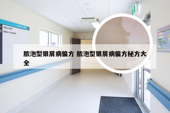 脓泡型银屑病偏方 脓泡型银屑病偏方秘方大全