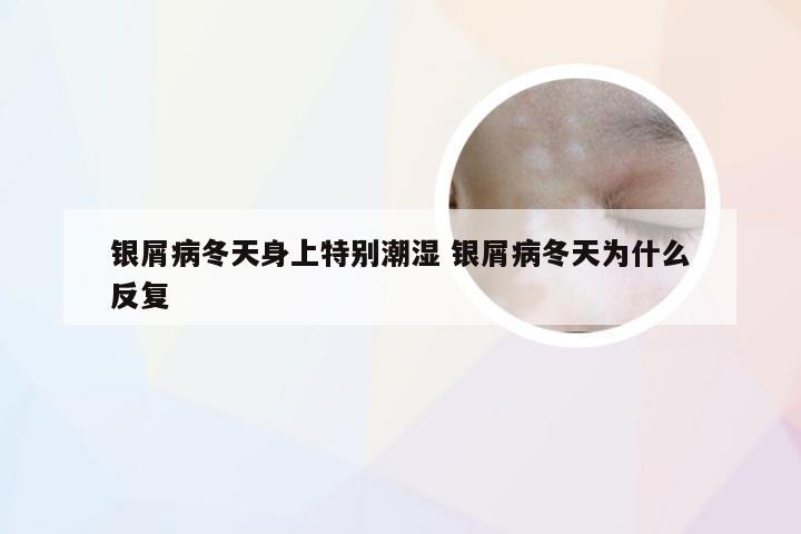 银屑病冬天身上特别潮湿 银屑病冬天为什么反复